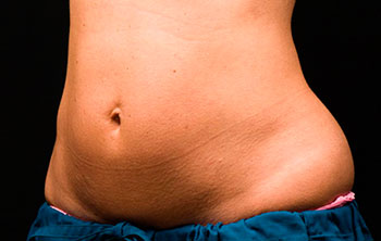 looduslik jogurt rasva kadu poletada keharasva raseduse ajal