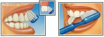 hammaste harjamine pohjustab kaalulanguse
